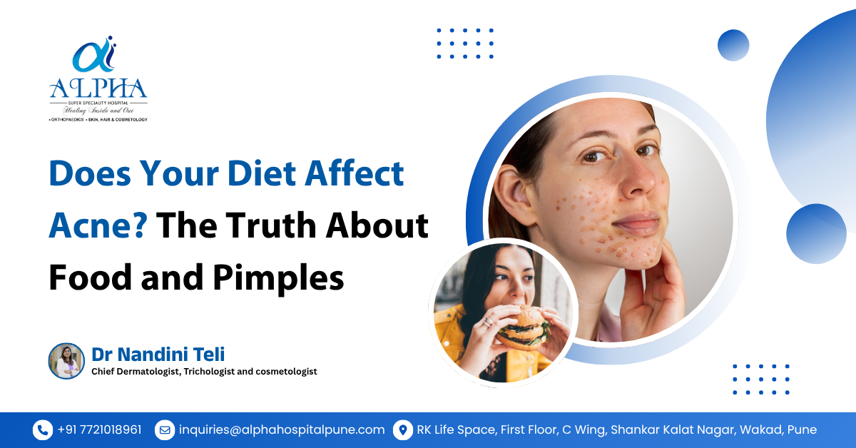 Does Your Diet Affect Acne? The Truth About Food and Pimples - Dr. Nandini Teli