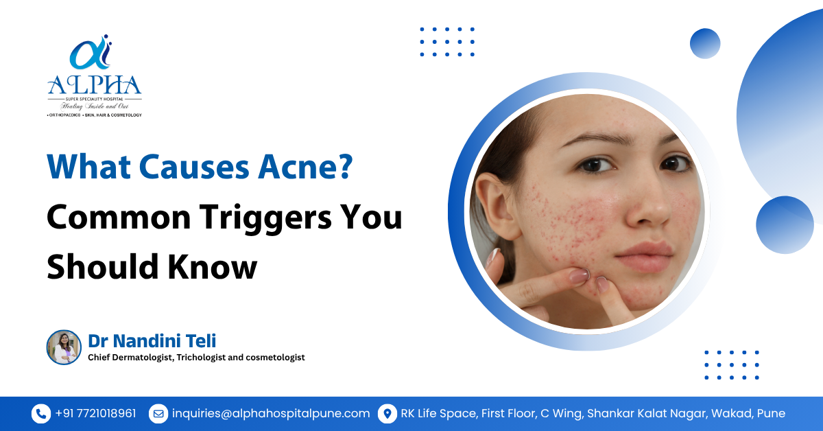 What Causes Acne? Common Triggers You Should Know - Dr. Nandini Teli