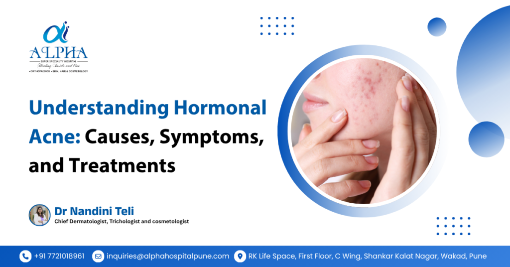 Hormonal acne is one of the most common skin concerns among teenagers and adults. It often appears when there’s an imbalance in hormones such as androgens, estrogen, or progesterone.