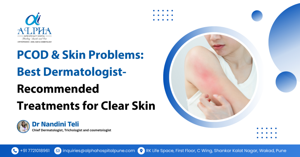 PCOD & Skin Problems: Best Dermatologist-Recommended Treatments for Clear Skin - Dr. Nandini Teli